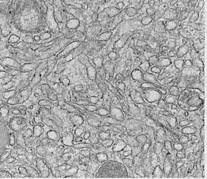 endoplasmic reticulum cartoon drawing - Clip Art Library